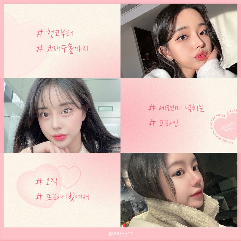 복코성형수술은 프라이빗성형외과 사진 6