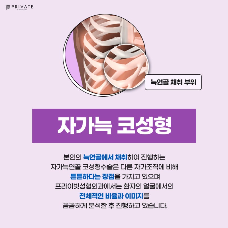 자가늑코성형잘하는병원 프라이빗성형외과
