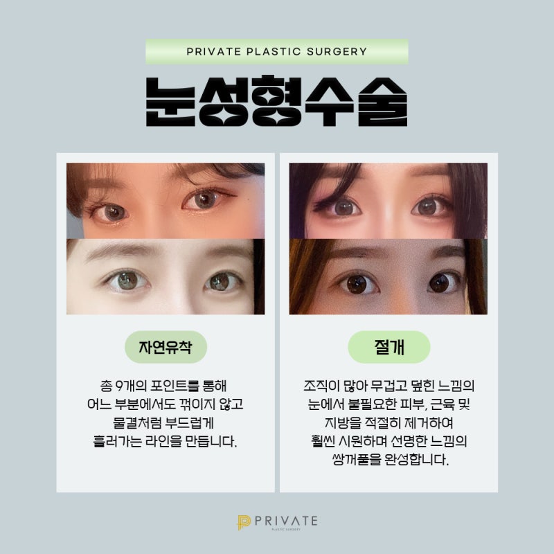 성형모델리얼모델프라이빗성형외과, 지금 바로 지원해보세요 사진 4