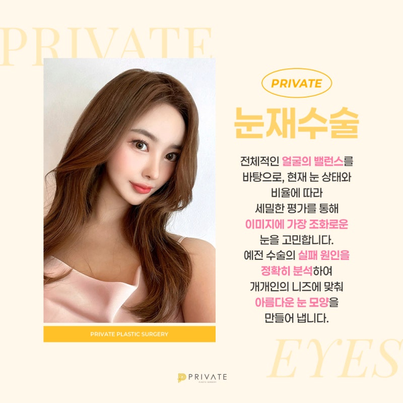 눈재수술성형은 신중하게, 프라이빗성형외과 사진 3