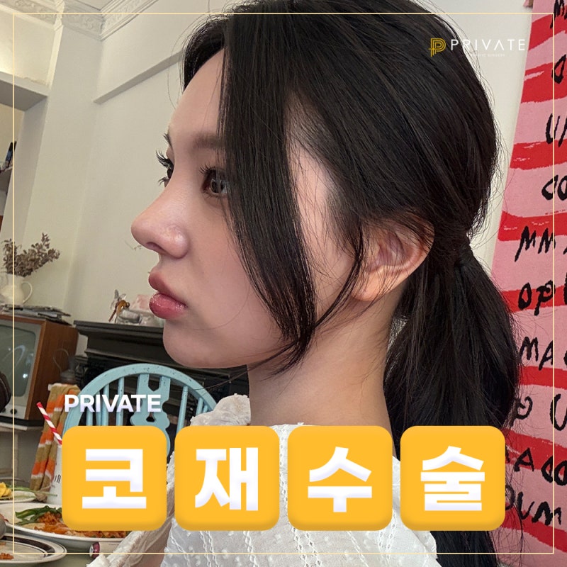 코재수술후기좋은곳 프라이빗성형외과 사진 2