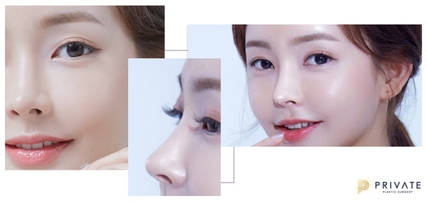 Private Plastic Surgery Clinic: The Star of Our Plastic Surgery Model Program is You 사진 6