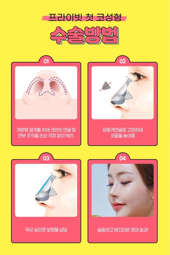 Operasi Plastik Mata dan Hidung di Sinsa Private Plastic Surgery