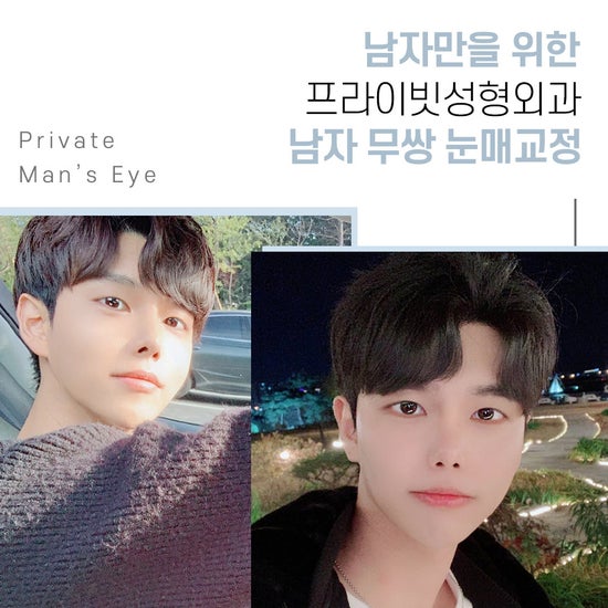 Эрэгтэй нүдний мэс засал хийдэг Private гоо сайхны мэс заслын эмнэлэг, давхраагүй нүдний хэлбэр засах мэс засал 사진 4