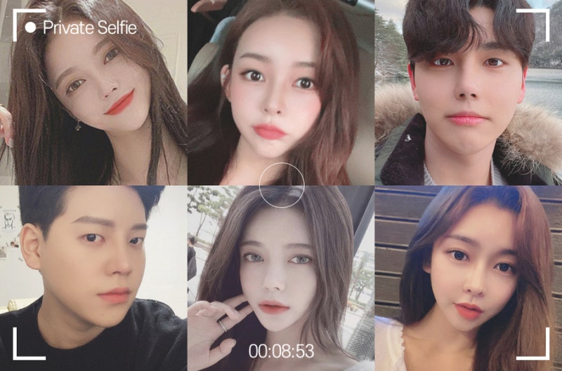 프라이빗성형외과 코재수술로 원하는 느낌 찾기 사진 6