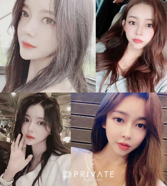 Eye Reoperation Plastic Surgery Clinic is Private Plastic Surgery Clinic 사진 5
