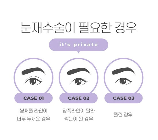 Eye Reoperation Plastic Surgery Clinic is Private Plastic Surgery Clinic