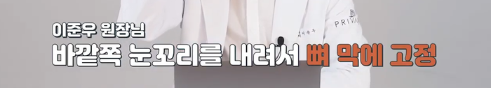 Private Plastic Surgery: Lateral Canthoplasty & Lower Canthoplasty with Director Lee Jun-woo 사진 11