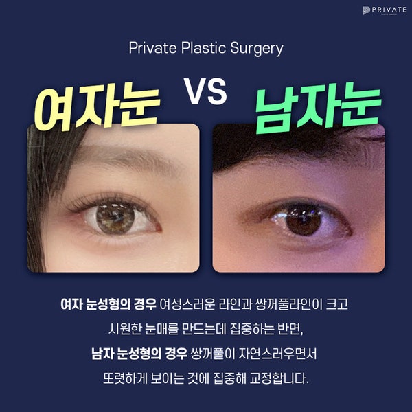 男士眼睑下垂矫正手术做得好的地方是Private整形外科,#李珍华 #李俊宇院长 사진 4