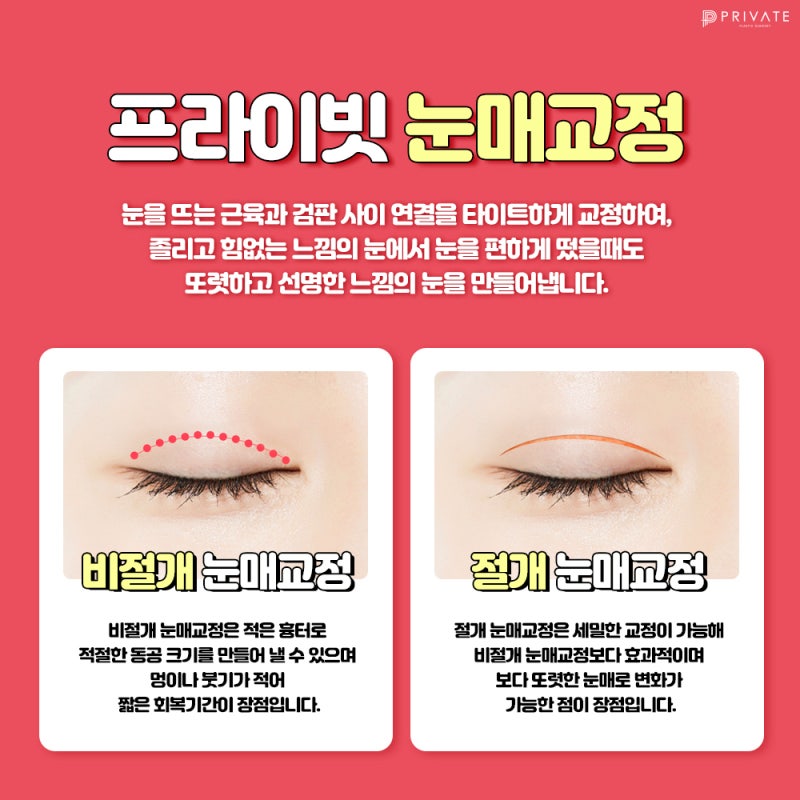 Private Plastic Surgery Clinic Excels in Ptosis Correction and Double Eyelid Surgery