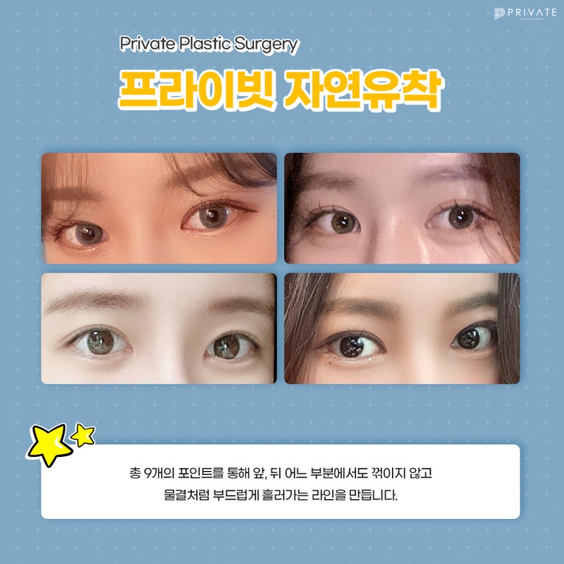 This is the place for excellent double eyelid surgery