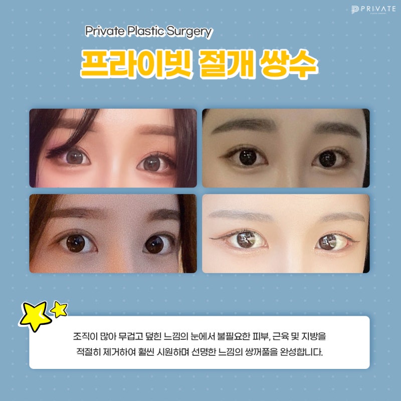 This is the place for excellent double eyelid surgery 사진 4