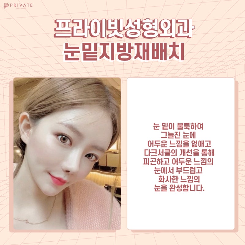 Lower Eyelid Fat Repositioning Surgery at Private Plastic Surgery Clinic