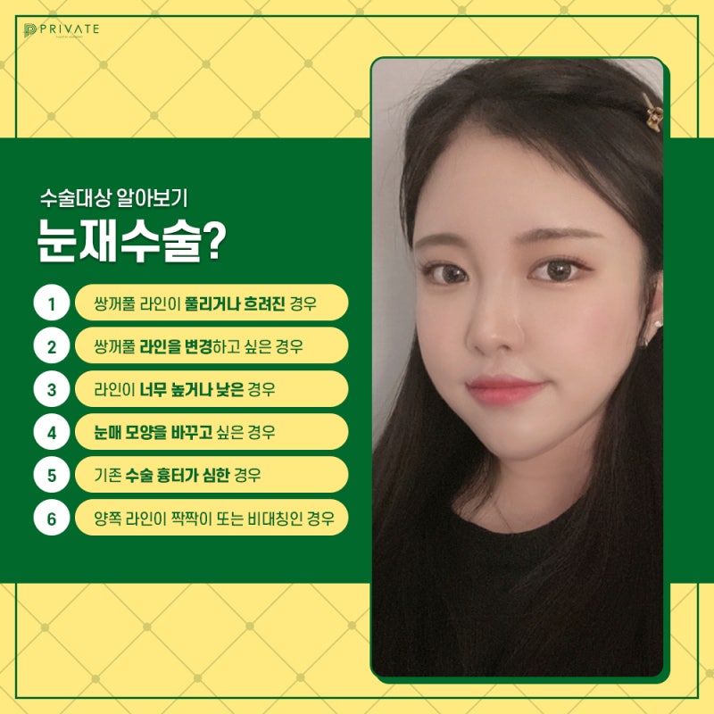 눈재수술잘하는곳은 여기 프라이빗성형외과 사진 5