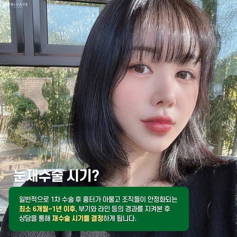 Private Plastic Surgery Clinic: The Best Place for Eye Reoperation 사진 4