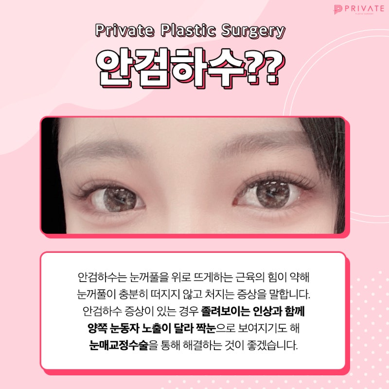 Ptosis Correction at Private Plastic Surgery