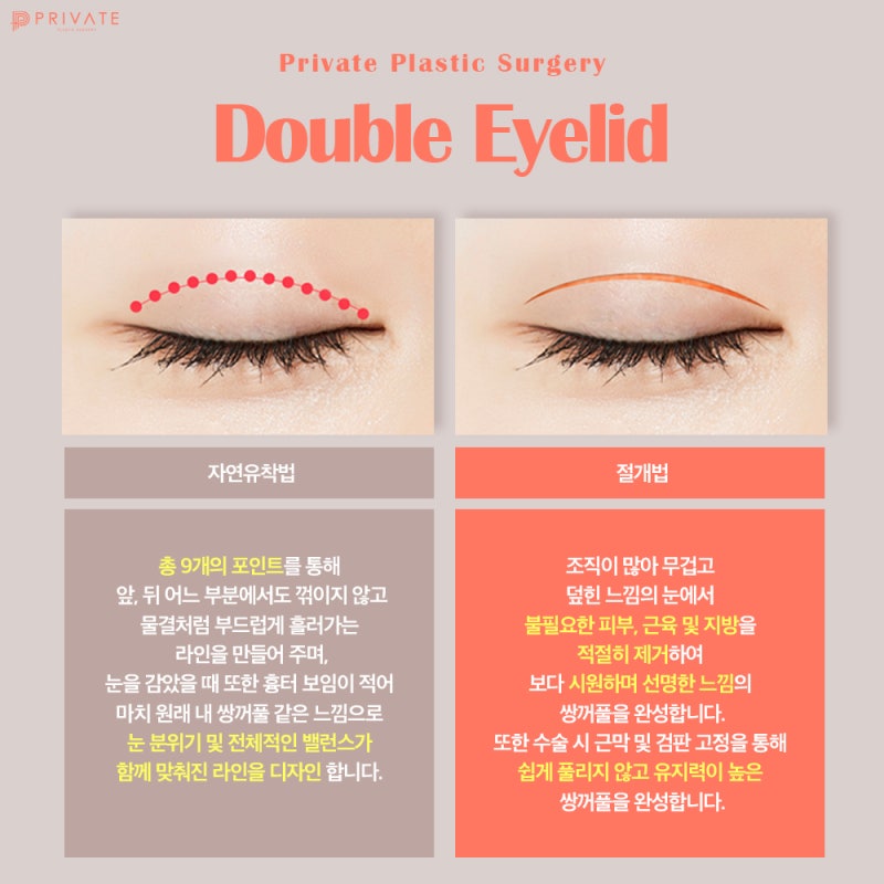 Private Plastic Surgery Clinic: Expert Eye Reoperation feat. Model Recruitment 사진 4