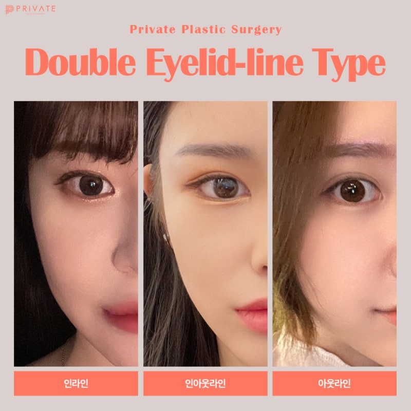 Private Plastic Surgery Clinic: Expert Eye Reoperation feat. Model Recruitment 사진 5