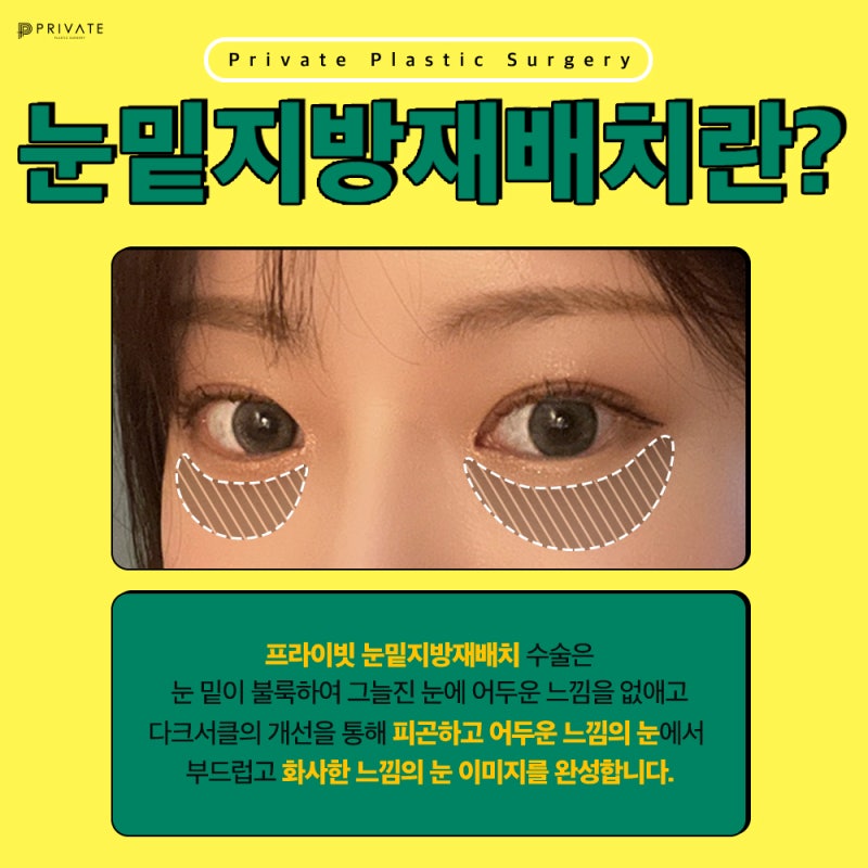 Let's Learn About Under-Eye Fat Repositioning Surgery at Private Plastic Surgery Clinic 사진 3