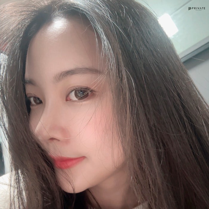 프라이빗성형외과 짧은코성형수술 알아보기 사진 6