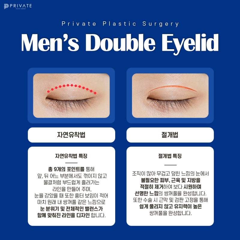 Private Plastic Surgery Clinic: The Best Place for Male Eye Surgery 사진 3