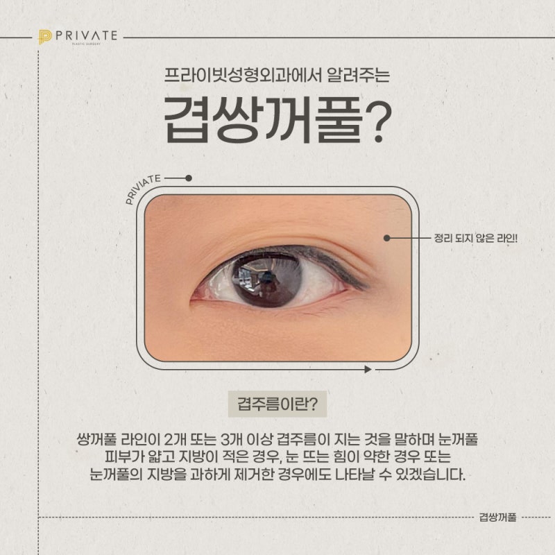 Learn About Double Eyelid Surgery at Private Plastic Surgery Clinic