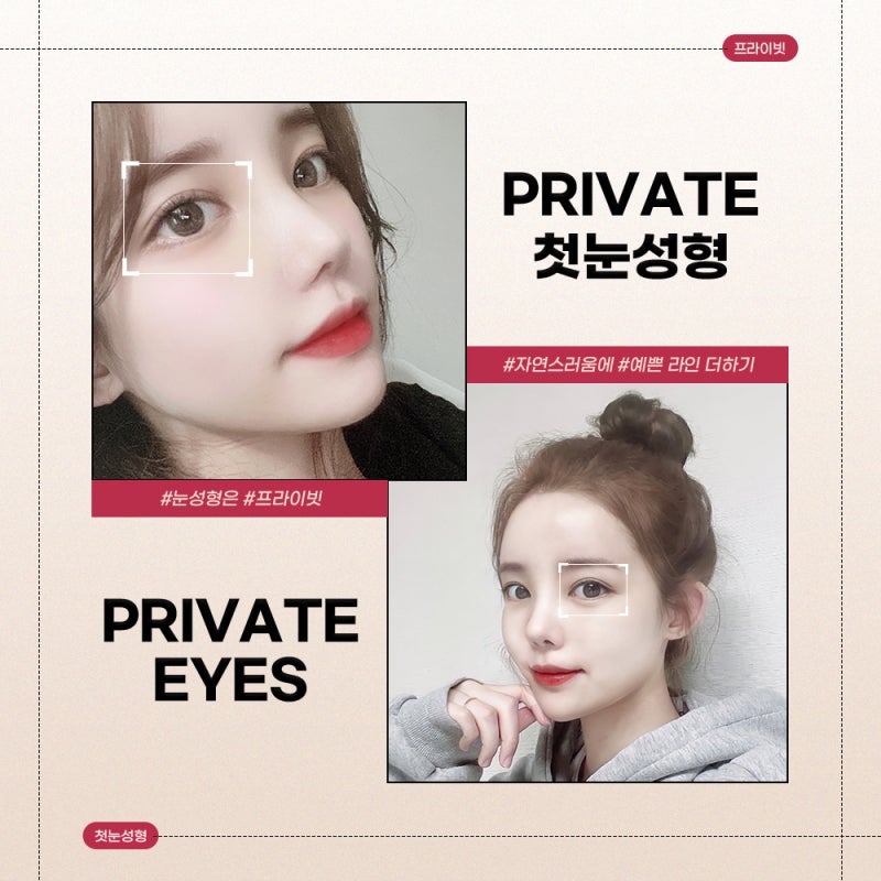 Private Plastic Surgery Clinic with Excellent Before-and-After Eye Surgery Results 사진 7