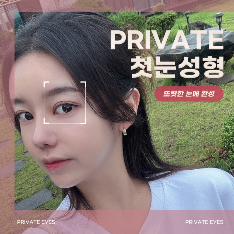 Private Plastic Surgery Clinic with Excellent Before-and-After Eye Surgery Results 사진 2
