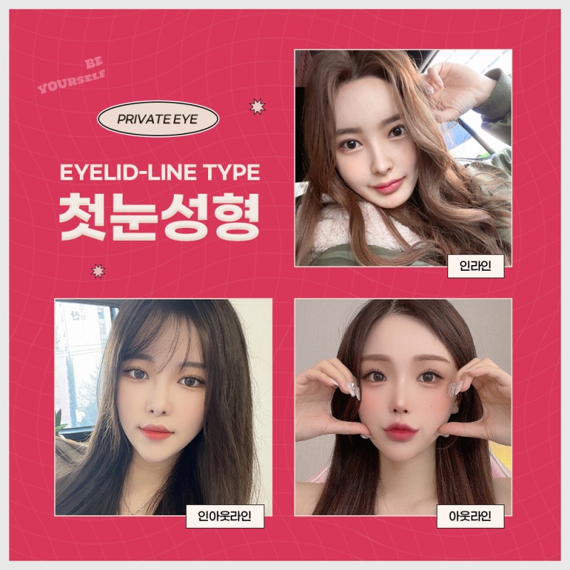 Private Plastic Surgery Clinic with Excellent Before-and-After Eye Surgery Results 사진 4