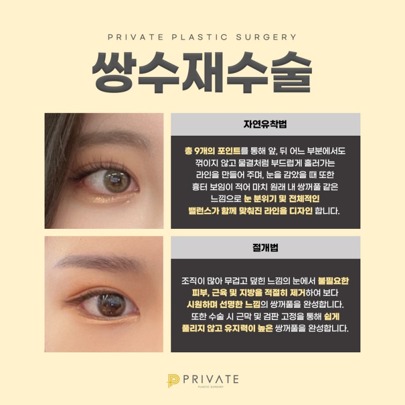 Double Eyelid Revision Surgery at Sinsa Private Plastic Surgery 사진 4