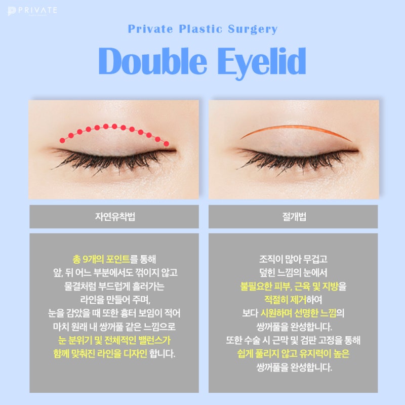 Sinsa Private Plastic Surgery: Renowned for Eye Reoperation 사진 4