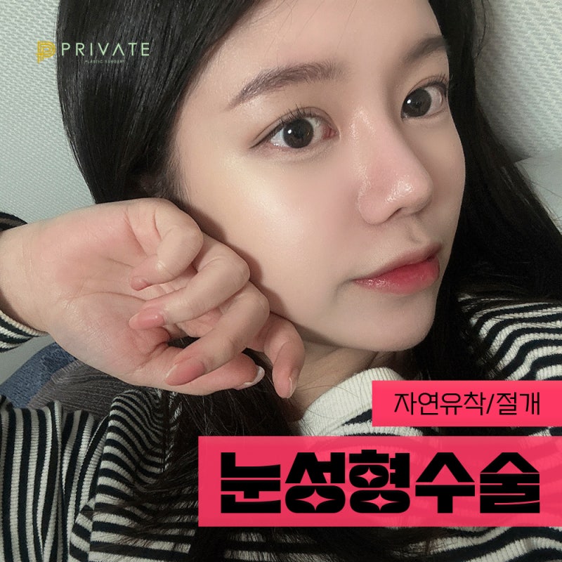 Sinsa Private Plastic Surgery: The Best Place for Double Eyelid Surgery 사진 2