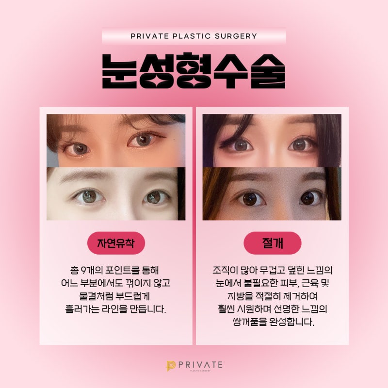 Sinsa Private Plastic Surgery: The Best Place for Double Eyelid Surgery