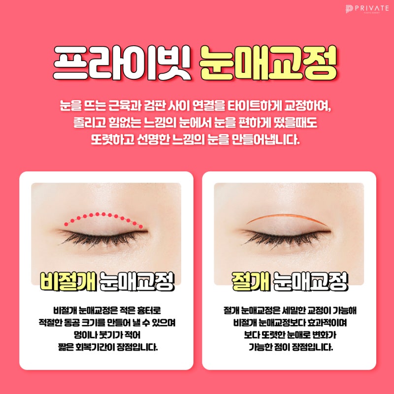 Ptosis Correction Surgery at Private Plastic Surgery Clinic, a Renowned Place