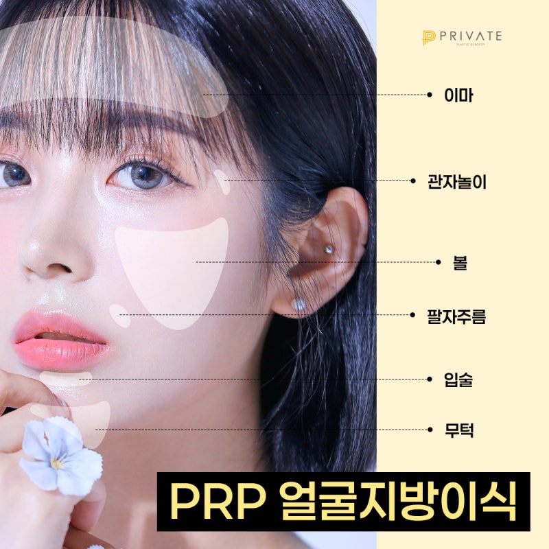 การปลูกถ่ายไขมันใบหน้า PRP ที่ Private Plastic Surgery Clinic สถานี Sinsa 사진 5