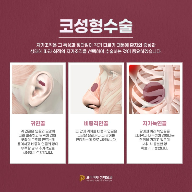如果您正在寻找知名的鼻部整形外科,请选择新沙Private整形外科 사진 5