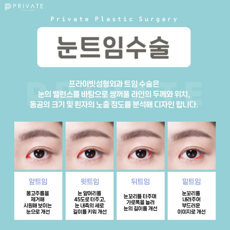눈 트임 성형외과 찾고 있다면 프라이빗성형외과