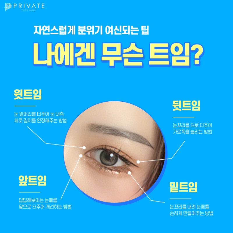 Phẫu thuật mở góc mắt dưới và sau tại Bệnh viện Thẩm mỹ Private Sinsa với nhiều đánh giá tốt