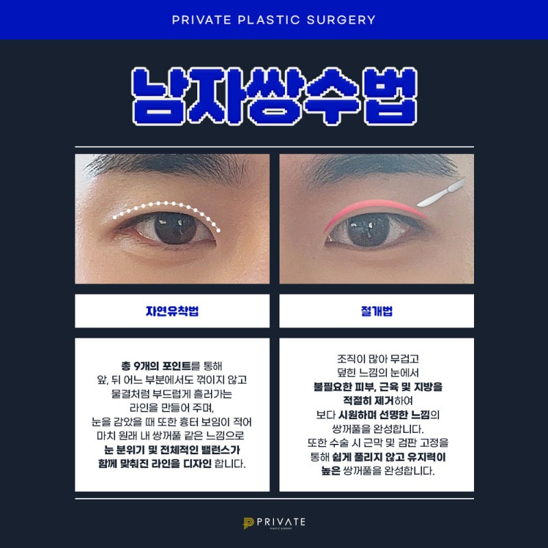 โรงพยาบาลทำตาสองชั้นสำหรับผู้ชาย: Private Plastic Surgery Clinic ในชินซา 사진 4