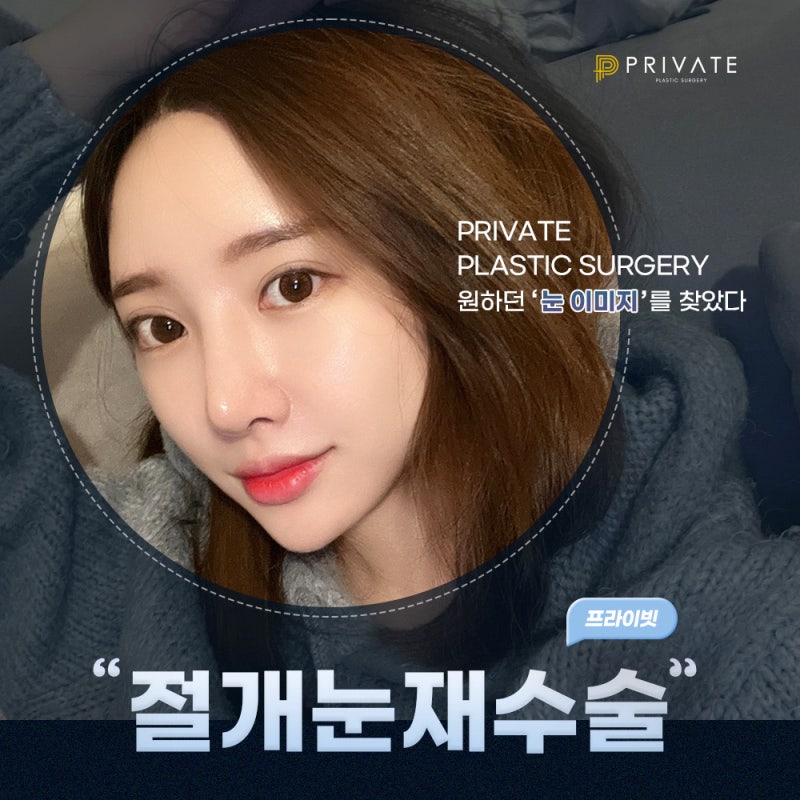 Double Eyelid Incision Revision Surgery at Sinsa Private Plastic Surgery 사진 2