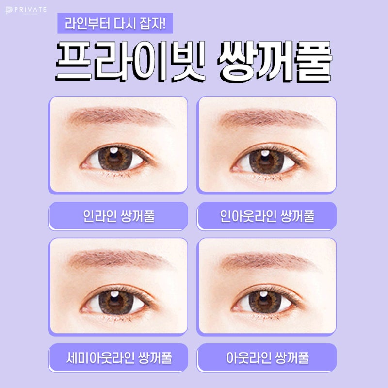 쌍수 잘하는 병원은 프라이빗성형외과 사진 4