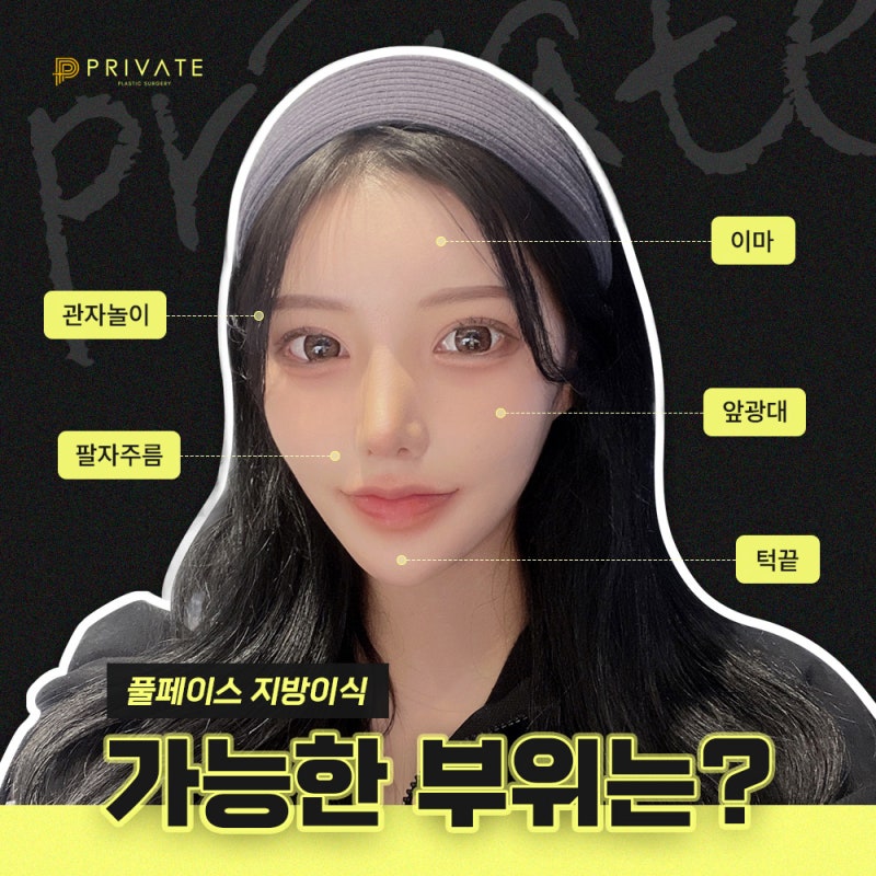 Operasi Transplantasi Lemak Wajah di Seoul adalah di Private Plastic Surgery 사진 4