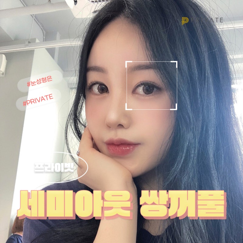 Semi-Outline Double Eyelid Surgery at Private Plastic Surgery Clinic 사진 2