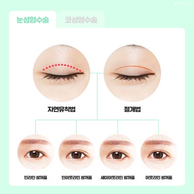 Learn About Eye and Nose Surgery for Students at Private Plastic Surgery 사진 4