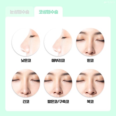 Learn About Eye and Nose Surgery for Students at Private Plastic Surgery 사진 5