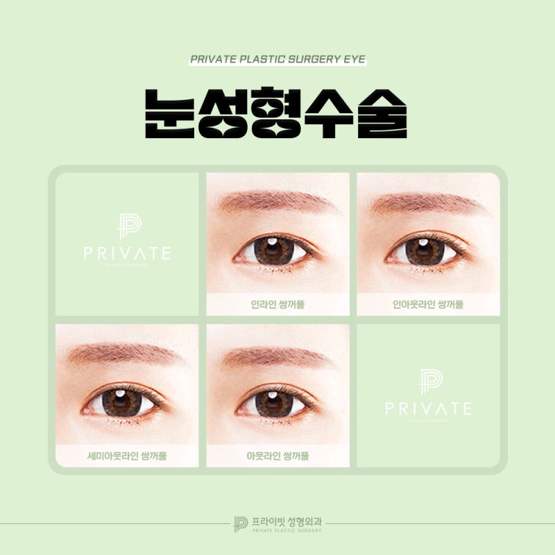 Types of Double Eyelids: Learn More at Private Plastic Surgery Clinic 사진 4