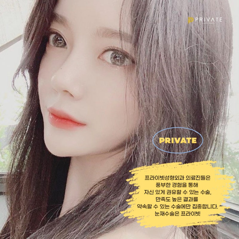 Phẫu thuật mắt hai mí lại tại Bệnh viện thẩm mỹ Private với những đánh giá tốt 사진 7