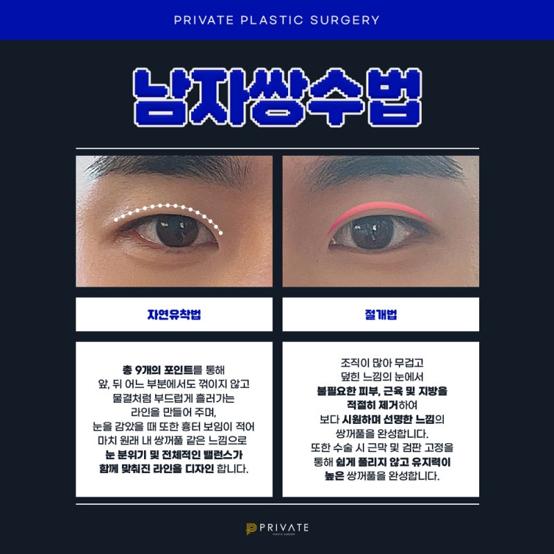 Private Plastic Surgery, Rumah Sakit Bedah Mata Pria yang Unggul 사진 3