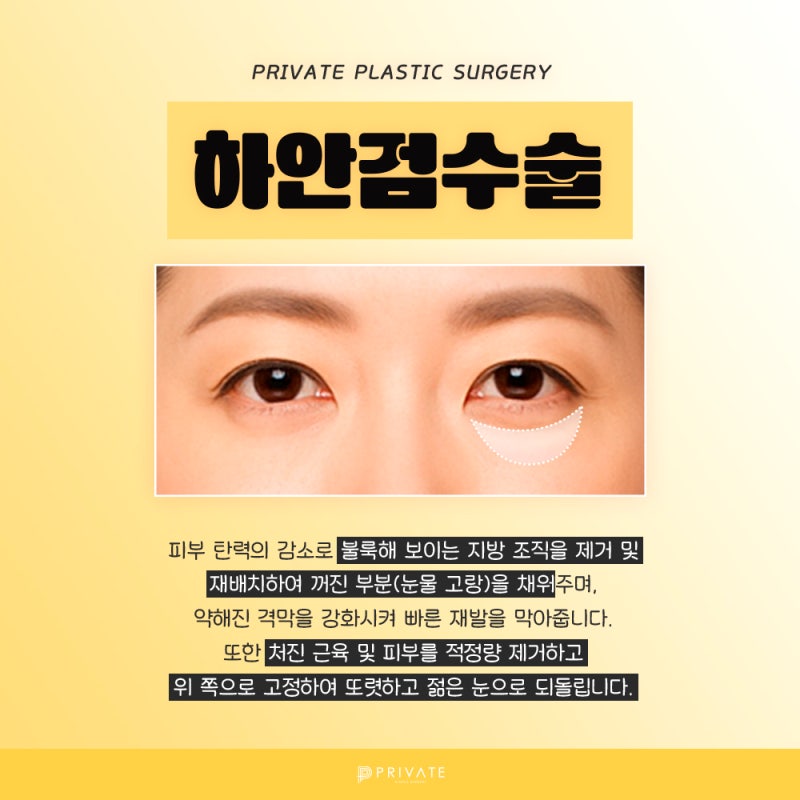 Sinsa Private Plastic Surgery: The Best Place for Lower Blepharoplasty