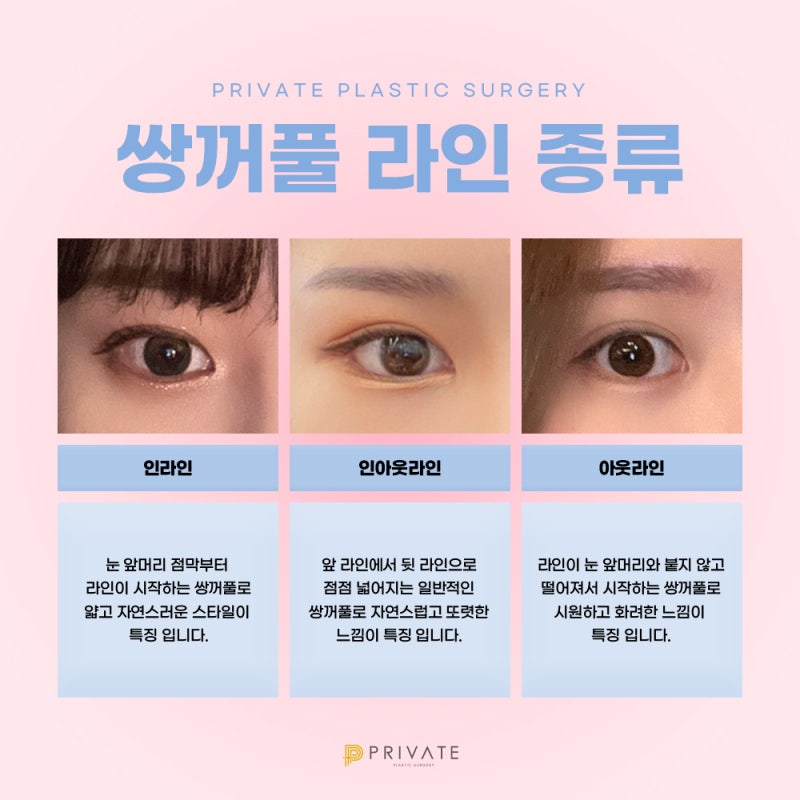 Private Plastic Surgery Clinic, Incisional Double Eyelid Surgery 사진 4